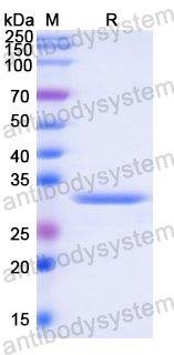 Recombinant Human DPYD Protein, N-His