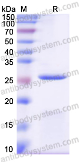 Recombinant Human FAP Protein, N-His