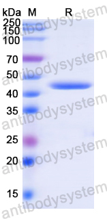 Recombinant Human FAP Protein, N-His