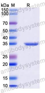 Recombinant Human COX10 Protein, N-GST & C-His