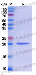 Recombinant Human AIMP1 Protein, N-His