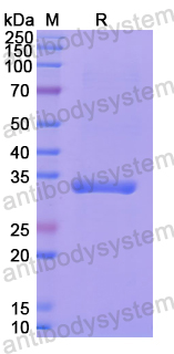 Recombinant Human LMAN2 Protein, N-His