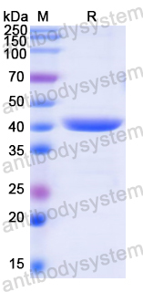 Recombinant Human CD148/PTPRJ Protein, N-His