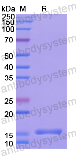 Recombinant Human CD161/KLRB1 Protein, N-His