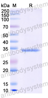 Recombinant Human GRIK2 Protein, N-His