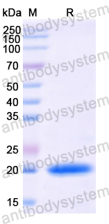 Recombinant Human IL24 Protein, N-His