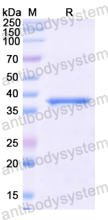 Recombinant Human ECH1 Protein, N-His