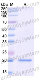 Recombinant Human CDC16 Protein, N-His