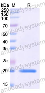 Recombinant Human STK4 Protein, N-His