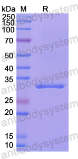 Recombinant Human COASY Protein, N-His