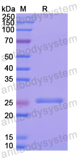 Recombinant Human PDIA2 Protein, N-His