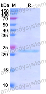 Recombinant Human SPP2 Protein, N-His