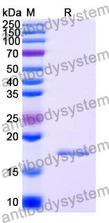 Recombinant Human CHAF1A Protein, N-His