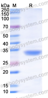 Recombinant Human MTAP Protein, N-His