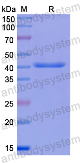 Recombinant Human REST Protein, N-His