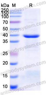 Recombinant Human NR1H3 Protein, N-His