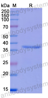 Recombinant Human BAMBI Protein, N-GST