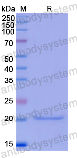 Recombinant Human TDP43 Protein, N-His