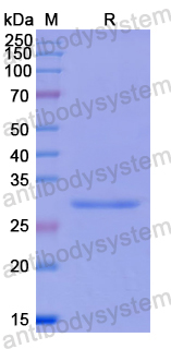 Recombinant Human PAK1 Protein, N-His