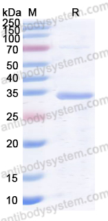 Recombinant Human PAK2 Protein, N-His