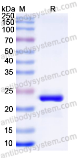 Recombinant Human CBX3 Protein, N-His