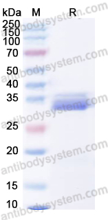 Recombinant Human PAPPA Protein, N-His