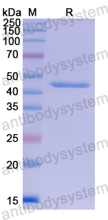 Recombinant Human GRIN2B Protein, N-His