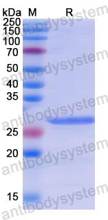 Recombinant Human SELENBP1 Protein, N-His
