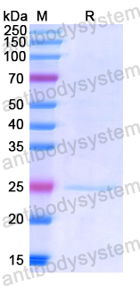 Recombinant Human MAP3K1 Protein, N-His