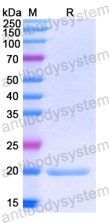 Recombinant Human CD94/KLRD1 Protein, N-His