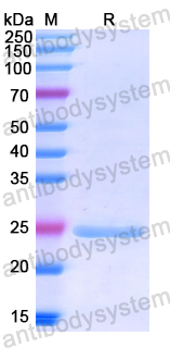Recombinant Human NOG Protein, N-His