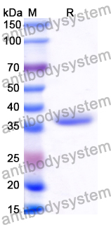 Recombinant Human CD215/IL15RA Protein, N-GST & C-His