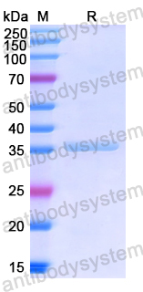 Recombinant Human GPR17 Protein, N-GST