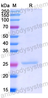 Recombinant Human PTK7 Protein, N-His