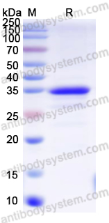 Recombinant Human SKP2 Protein, N-His