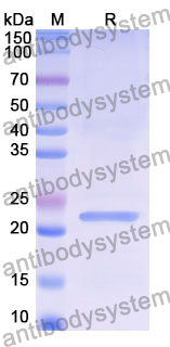 Recombinant Human CRHR2 Protein, N-His-SUMO