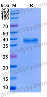 Recombinant Human EIF3I Protein, N-His