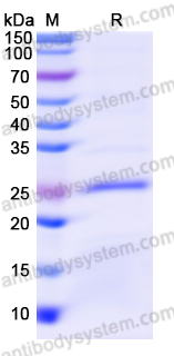Recombinant Human MFAP5 Protein, N-His