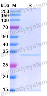 Recombinant Human CTBP1 Protein, N-His