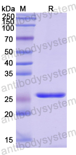 Recombinant Human AP3B2 Protein, N-His