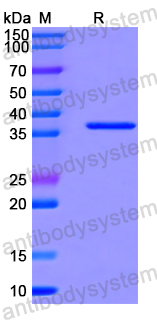 Recombinant Human MYO7A Protein, N-His