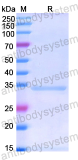 Recombinant Human ILK Protein, N-His