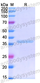 Recombinant Human MSLN Protein, N-His