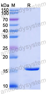 SDS-PAGE for Recombinant Human IKZF1 Protein, N-His ?>
