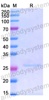 Recombinant Human SLC39A6 Protein, N-His