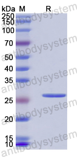 Recombinant Human ADAM15/MDC15 Protein, N-His-SUMO