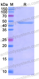 Recombinant Human FKBP5 Protein, N-His