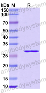 Recombinant Human FKBP5 Protein, N-His