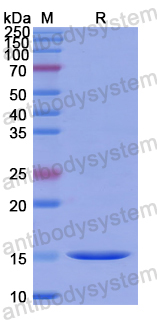 Recombinant Human CD218a/IL18R1 Protein, N-His