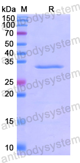 Recombinant Human GAB1 Protein, N-His